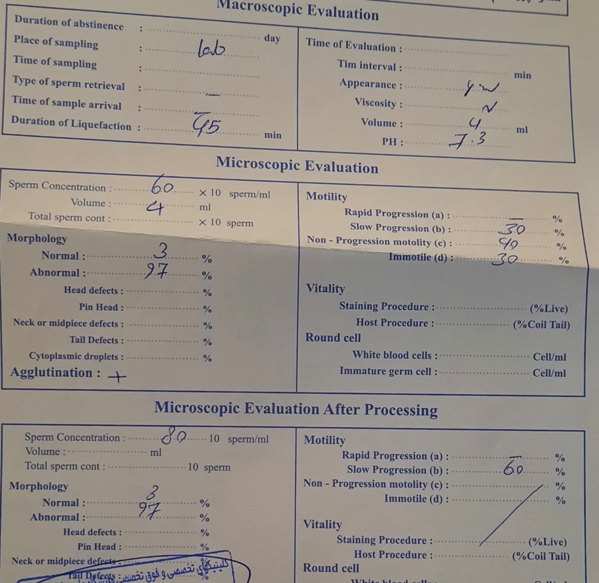 تفسیر آزمایش اسپرم
