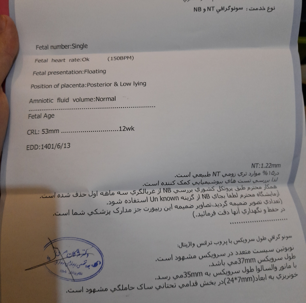 تفسیر سونو ان تی تفسیر سونو ان تی