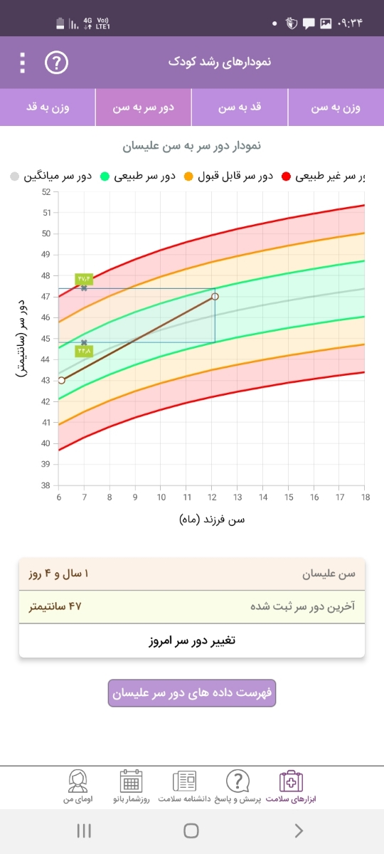 دورسر طبیعی کودک یکساله دورسر طبیعی کودک یکساله