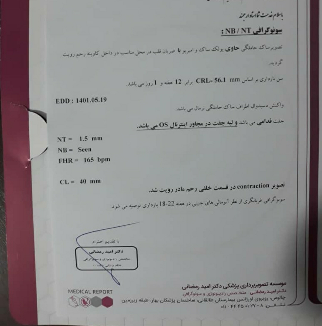 سونوی ان تی ۵ بهمن ۱۴۰۰ سونوی ان تی ۵ بهمن ۱۴۰۰