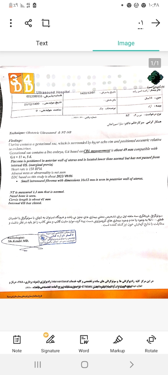 تفسیر سونوی ان تی