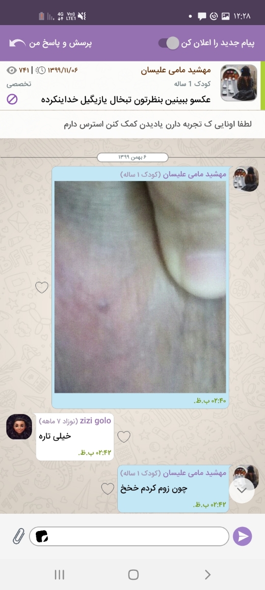 زگیل تناسلی همراه با عکس زگیل تناسلی همراه با عکس