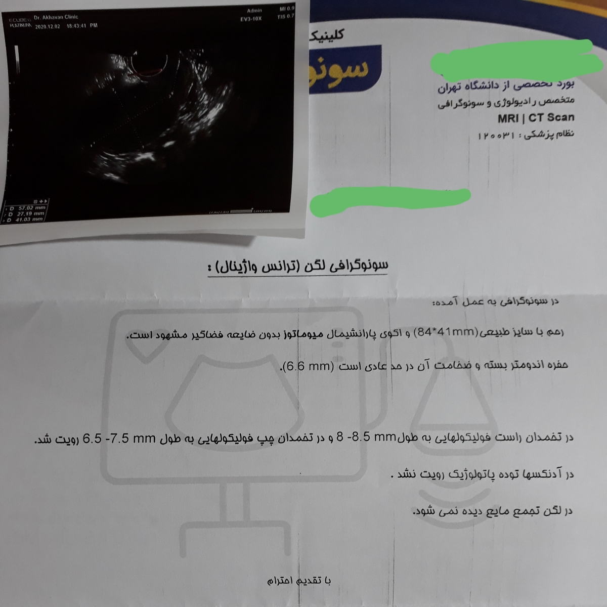 این سونوی دوممه که روز ۶ پریود دادم