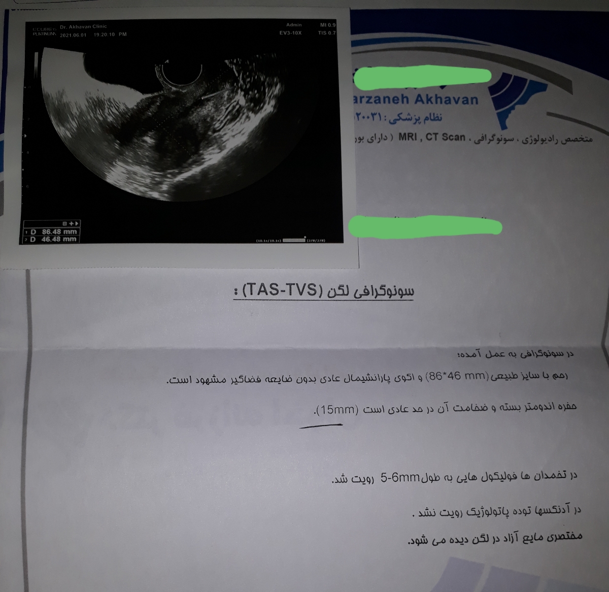اینم سونوی اولم هست که چند ماه پیش،چند روز قبل پریود دادم