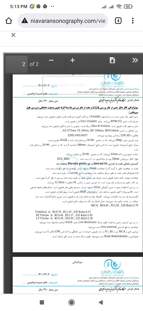 تفسیر سونو ۲۲هفته لطفا