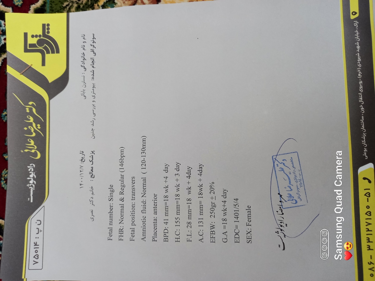 سلام تفسیرانومالی درهفته ۱۸😁