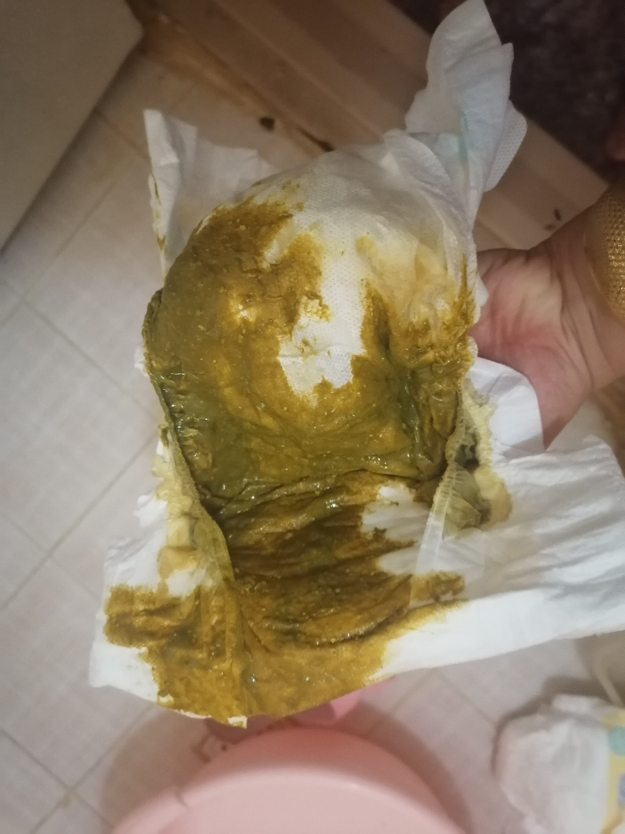 بی خوابی و اسهال نوزاد 42 روزه + عکس مدفوع