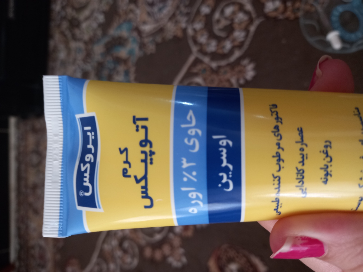 حساسیت پسرم و اگزمای بدن حساسیت پسرم و اگزمای بدن