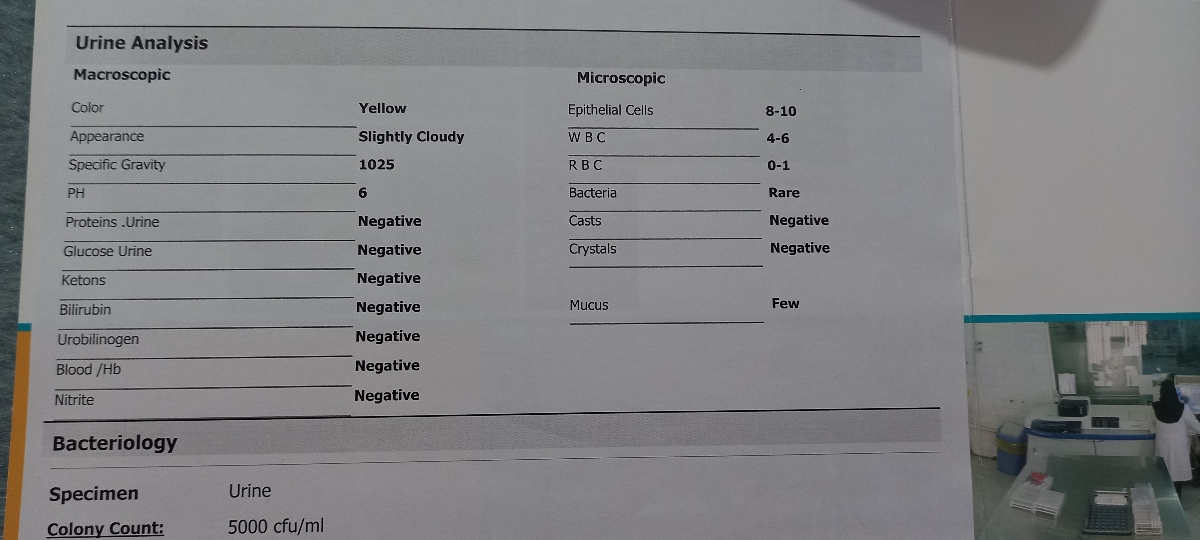 تفسیر آزمایش چکاب کامل