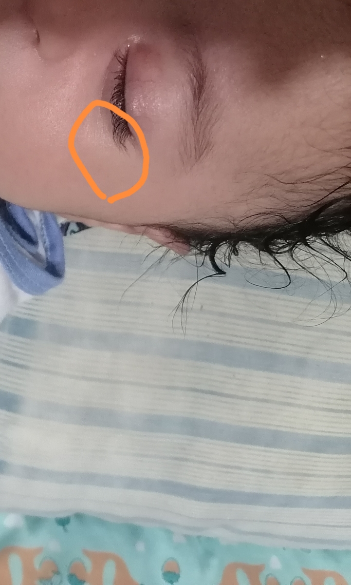 این قسمت ورم داره. هردو چشم. و زیر چشمشم گود شده این قسمت ورم داره. هردو چشم. و زیر چشمشم گود شده