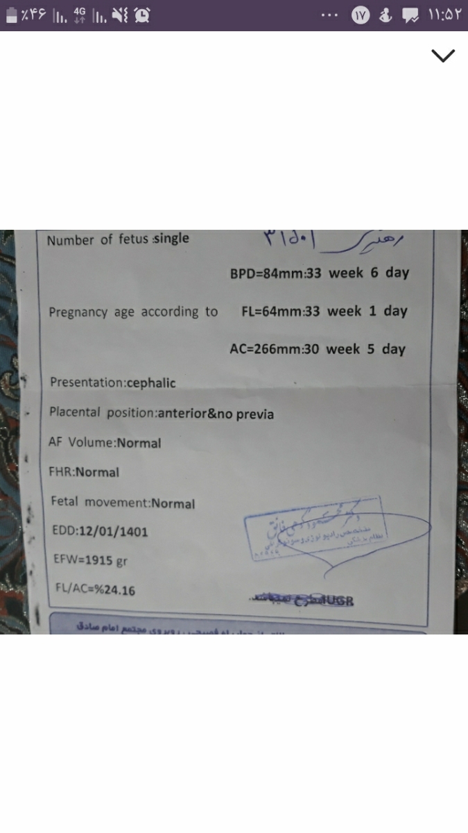 سونو ۳۳ هفته و ۳ روز 