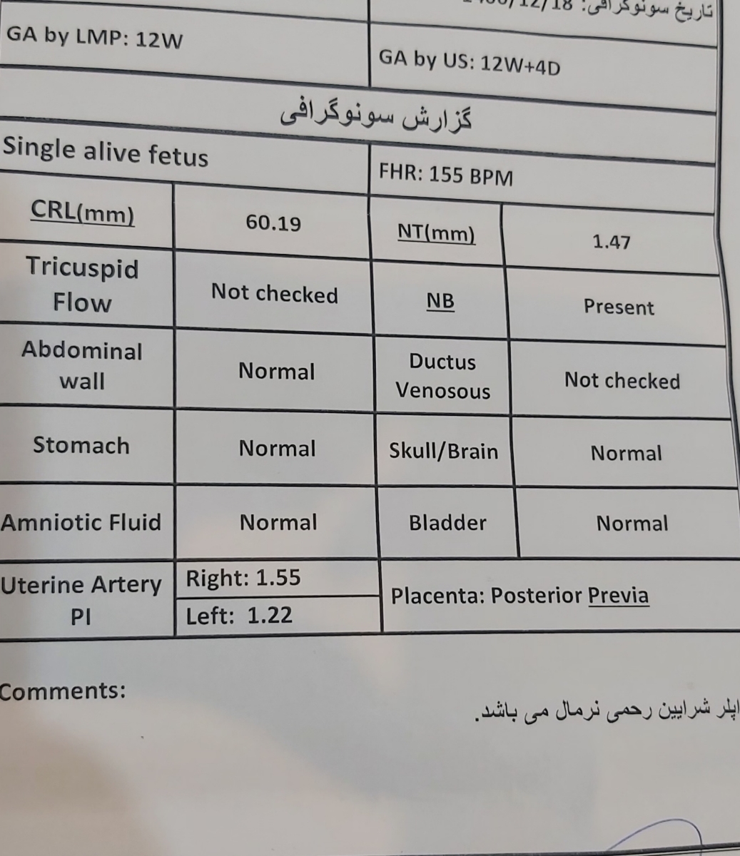 سونو ان تی و تعیین جنسیت