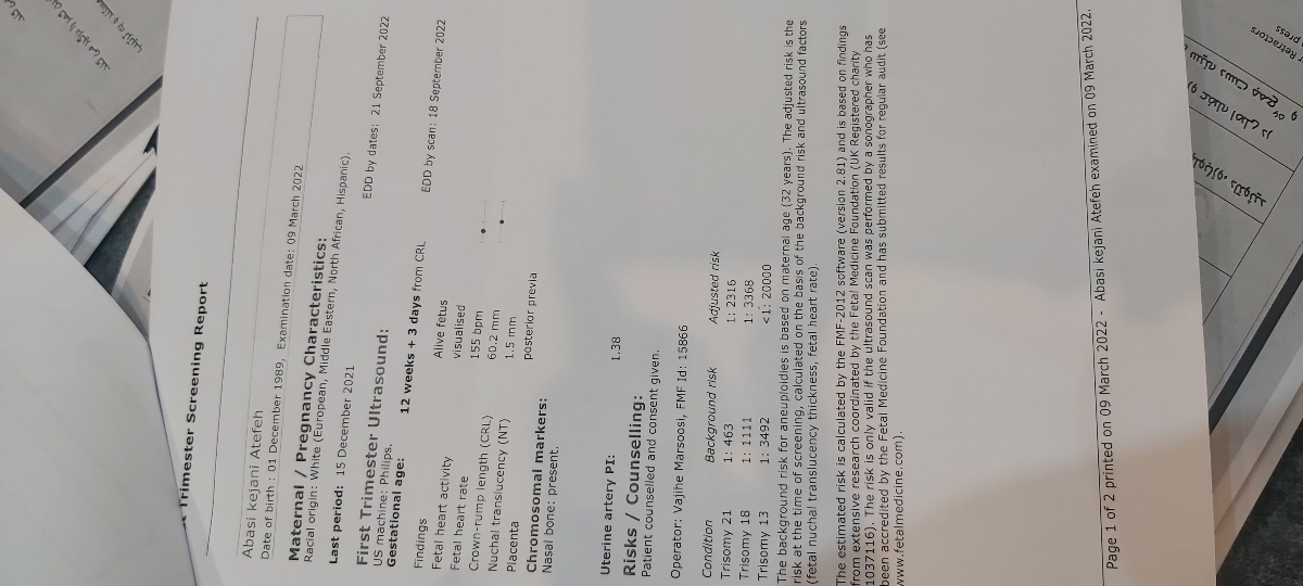 سونو ان تی و تعیین جنسیت