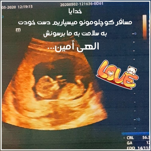 این برای من ۱۲ هفته کامل بود در حال شصت خوردن🤣ولی دکتر گفت جنسیت معلوم نیس.۱۶ هفته رفتم گفت پسره