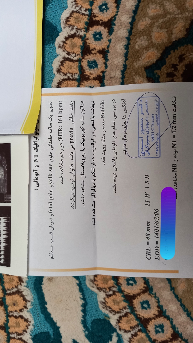 ❓❓تفسیر سونو ان تی و تعیین جنسیت ❓❓تفسیر سونو ان تی و تعیین جنسیت