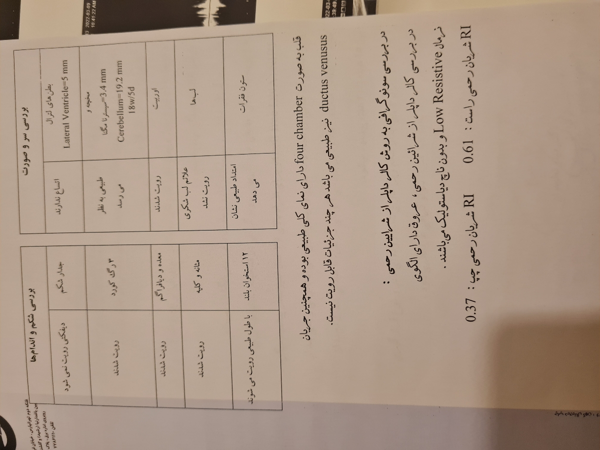 تفسیر سونو انومالی