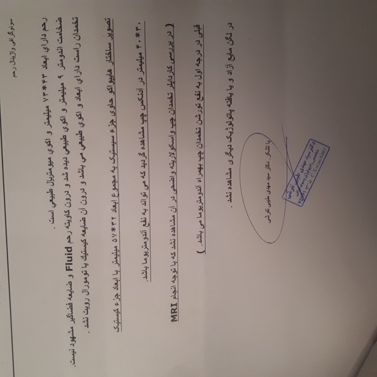 کیست آندومتریوما در تخمدان چپ