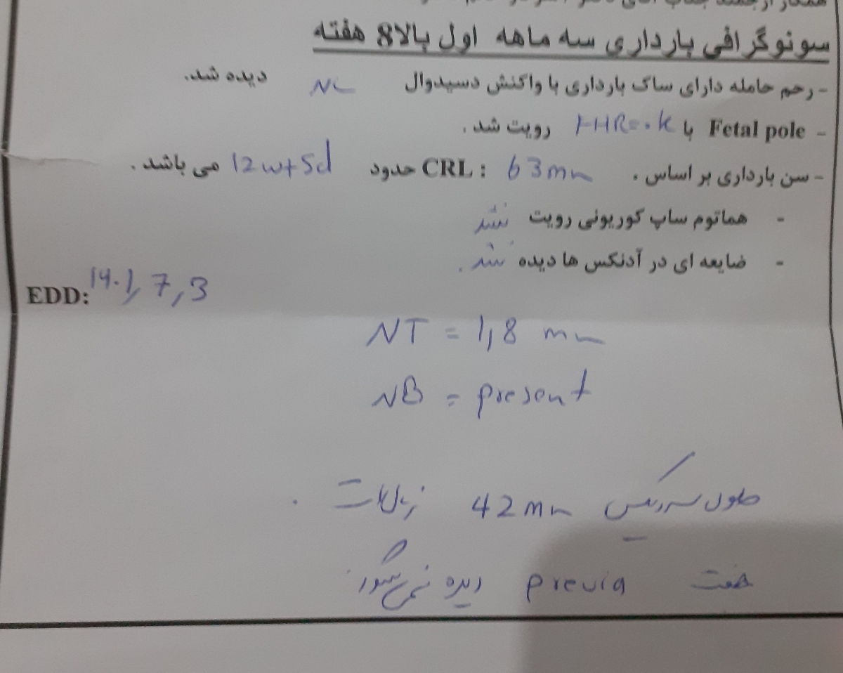 تفسیر سونو ان تی