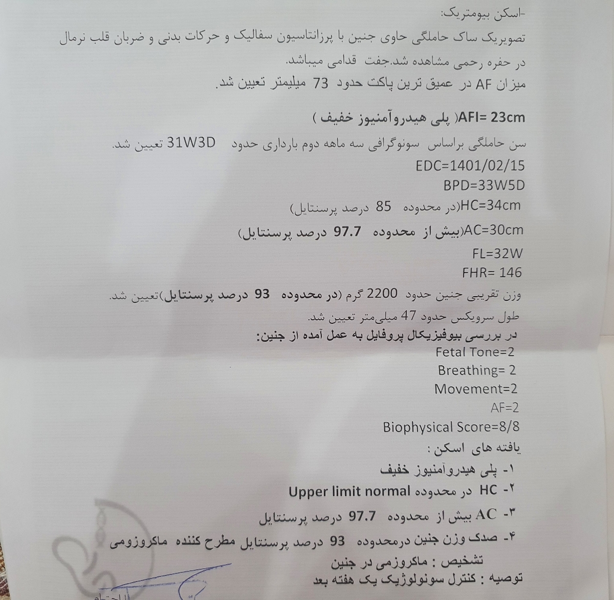 وزن جنین هفته ۳۳ وزن جنین هفته ۳۳