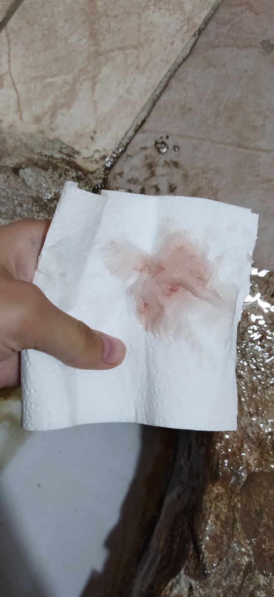 دیدن خون تو هفته۲۵