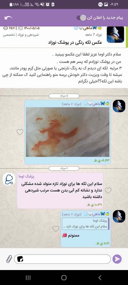 لکه نارنجی نوزاد ۳ روزه لکه نارنجی نوزاد ۳ روزه