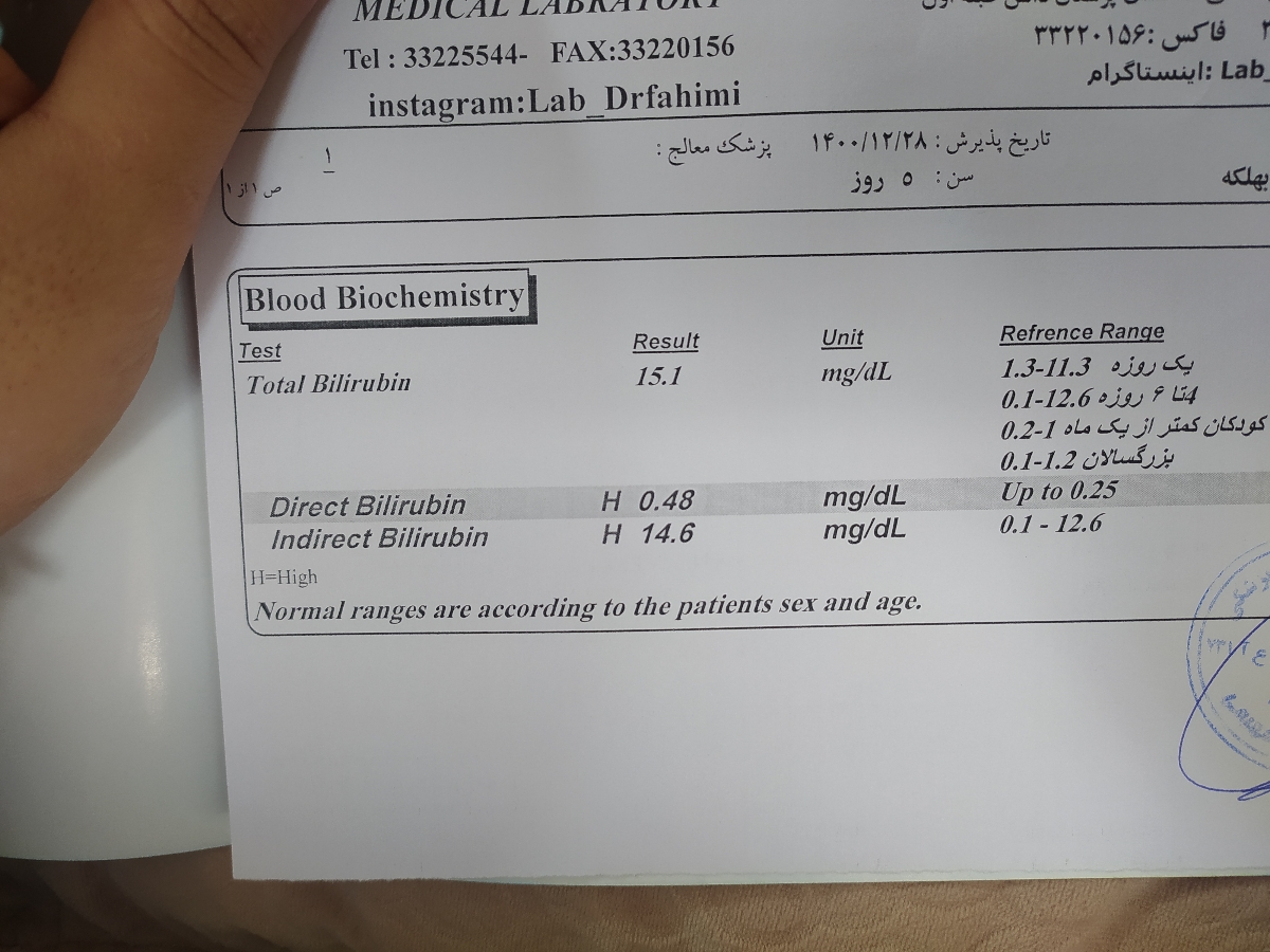 خانوم دکتر و اومایی ها جواب زردی بچه م رو میبینین؟ خانوم دکتر و اومایی ها جواب زردی بچه م رو میبینین؟