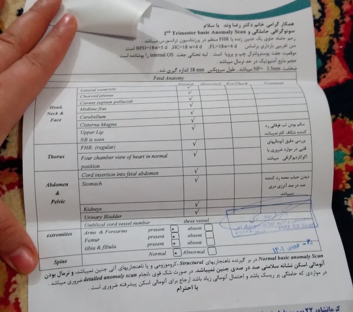 تفسیر آزمایش آنومالی امروز