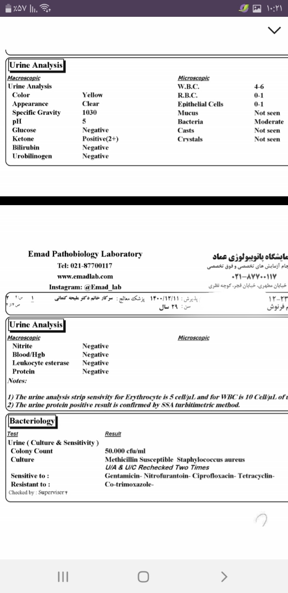 ازمایش بار اول ازمایش بار اول