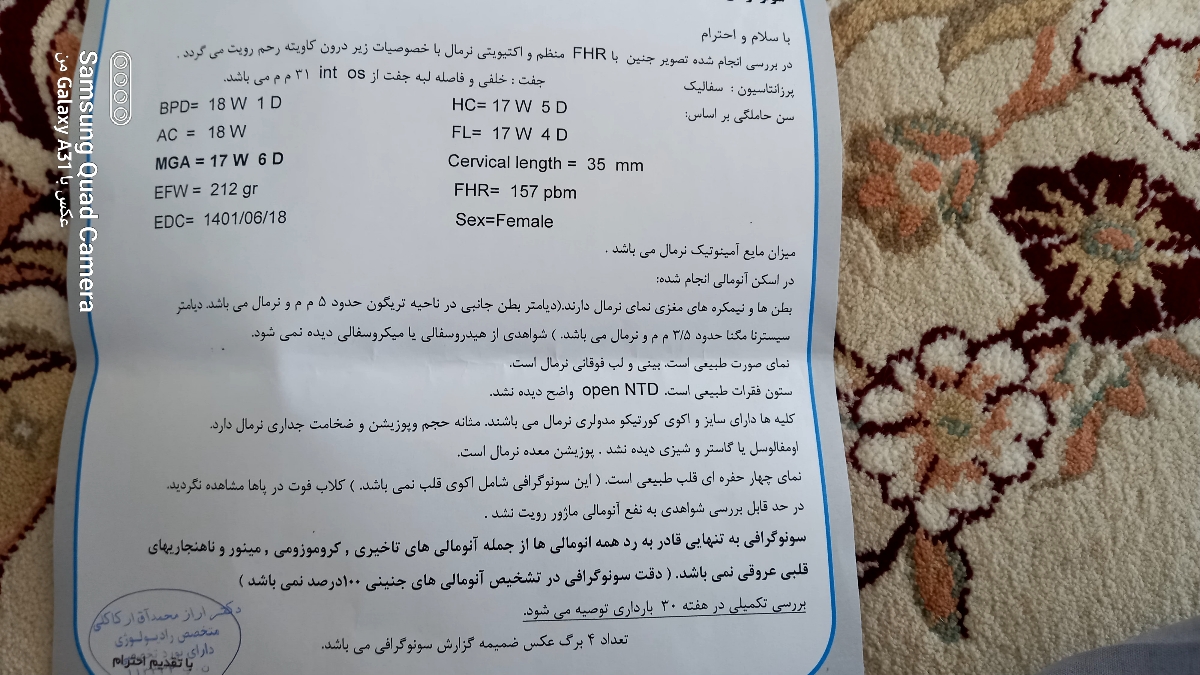 سلام سنو انومالی برام تفسیر کنید سلام سنو انومالی برام تفسیر کنید