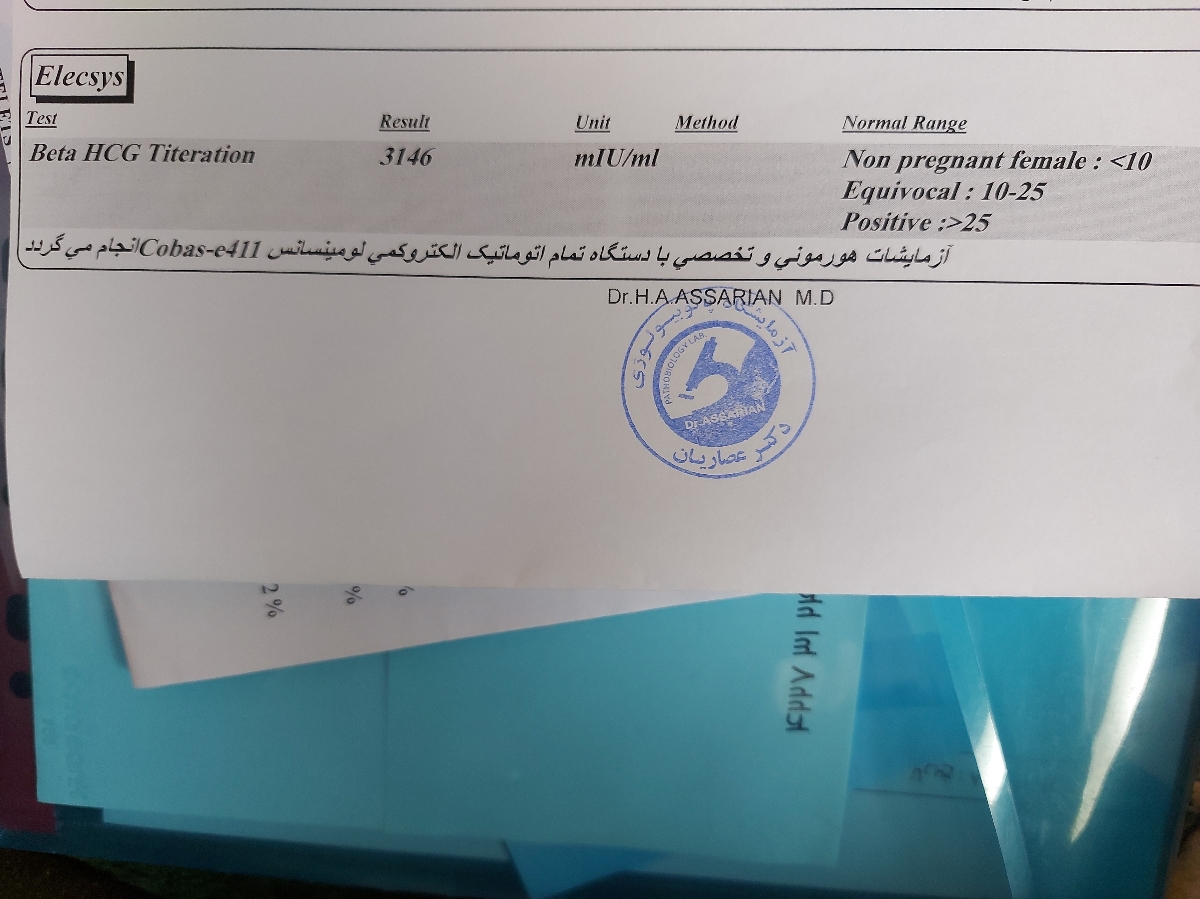 تفسیر سونو و آزمایش بارداری تفسیر سونو و آزمایش بارداری
