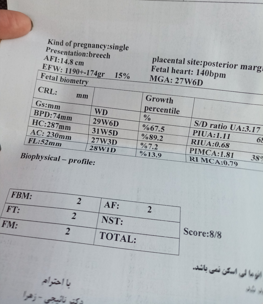 این سونورو امروز دادم