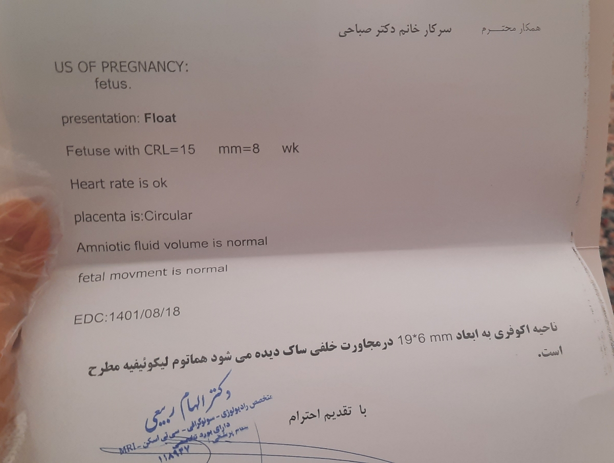 قطع کردن قرص آسپرین ۸۰ قطع کردن قرص آسپرین ۸۰