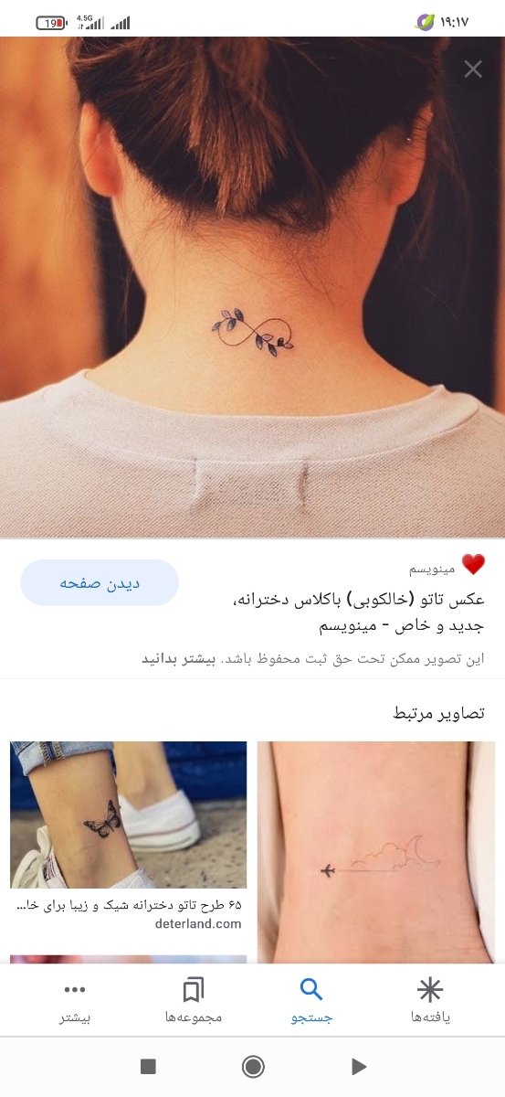 تزریق ژل لب و ابرو جهت زیبایی😍 تزریق ژل لب و ابرو جهت زیبایی😍