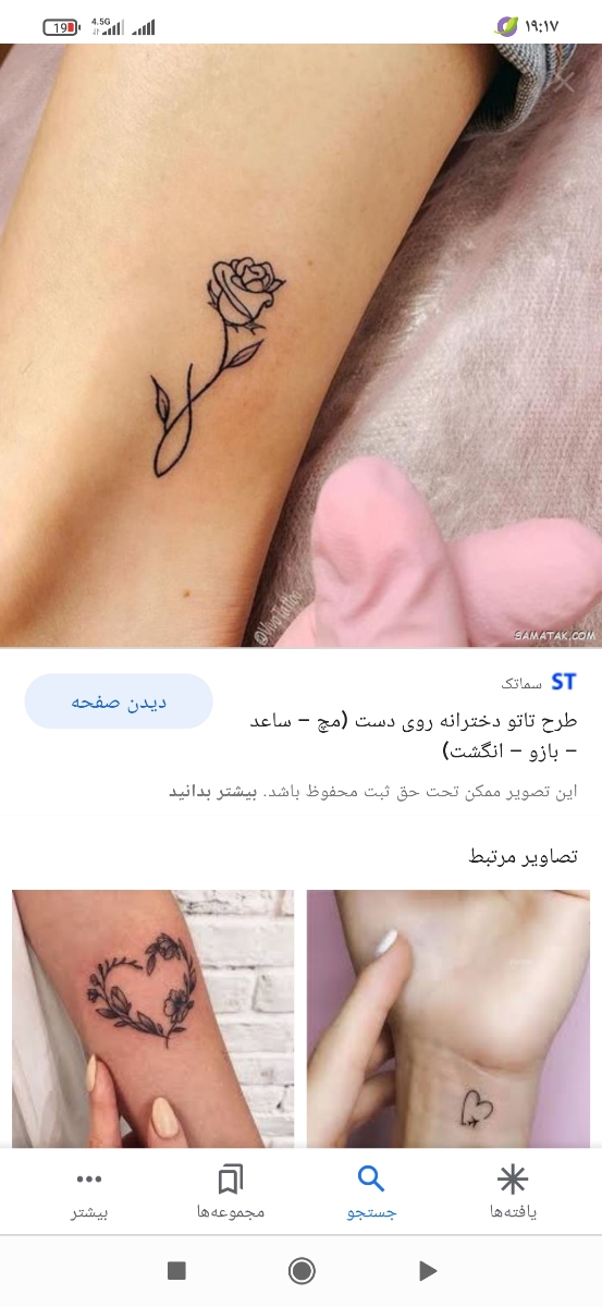 تزریق ژل لب و ابرو جهت زیبایی😍 تزریق ژل لب و ابرو جهت زیبایی😍