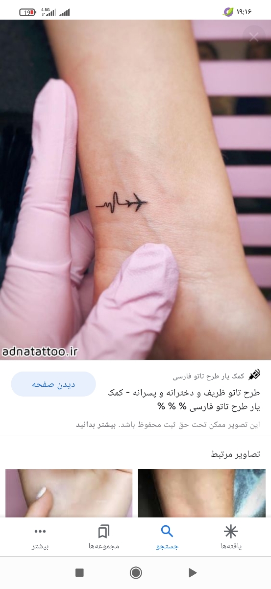 تزریق ژل لب و ابرو جهت زیبایی😍 تزریق ژل لب و ابرو جهت زیبایی😍