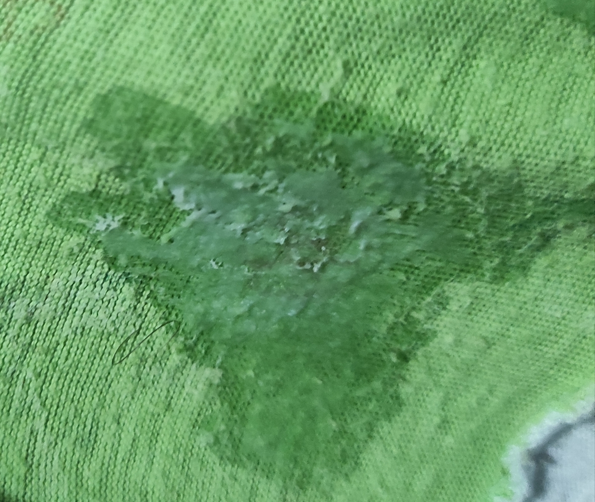 ترشحات در هفته ۳۵بارداری