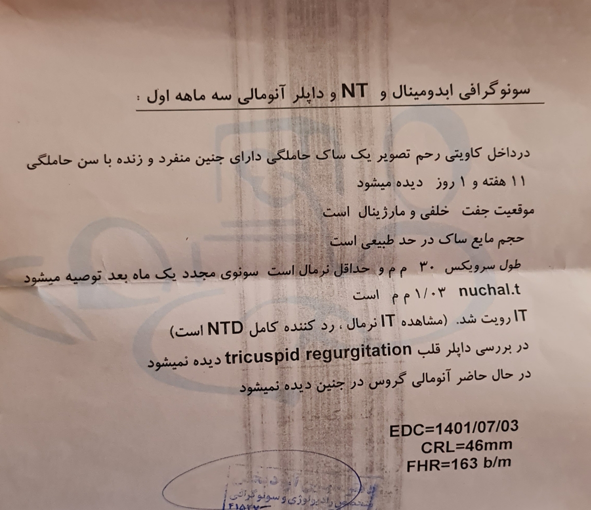 اینم سونویnt اینم سونویnt