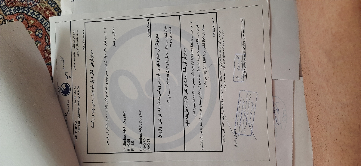 خلف جفت ازنظر اکرتا