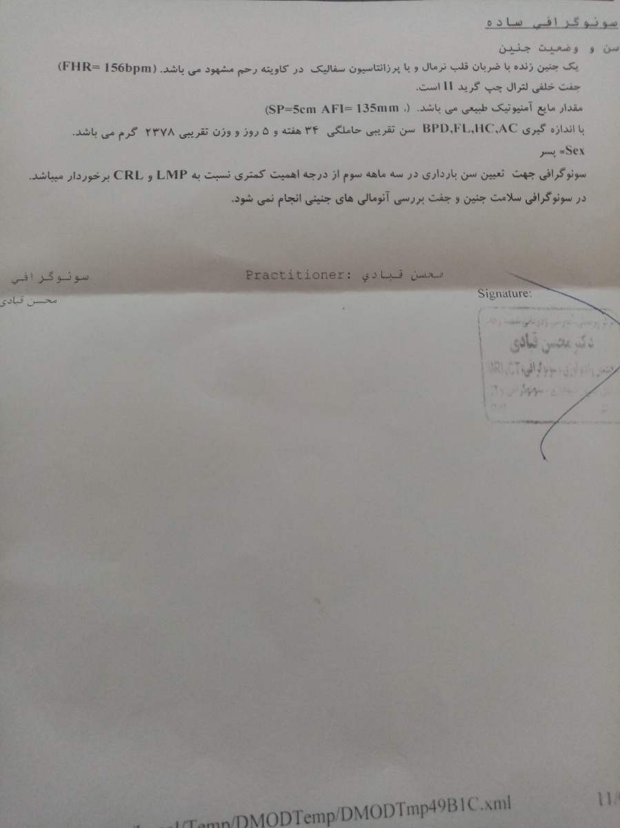 تفسیر سنو ماه آخر 🤔 تفسیر سنو ماه آخر 🤔