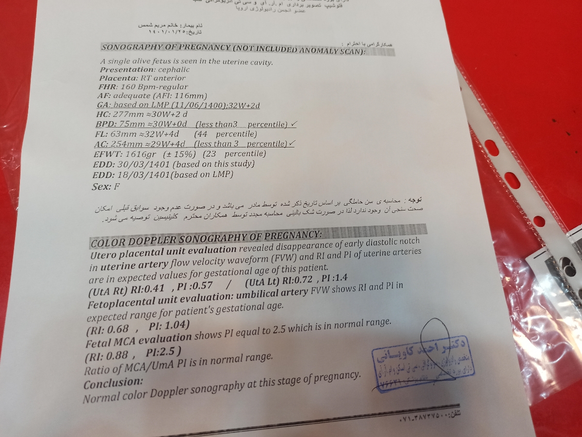 اینم سنو۳داپلر اینم سنو۳داپلر