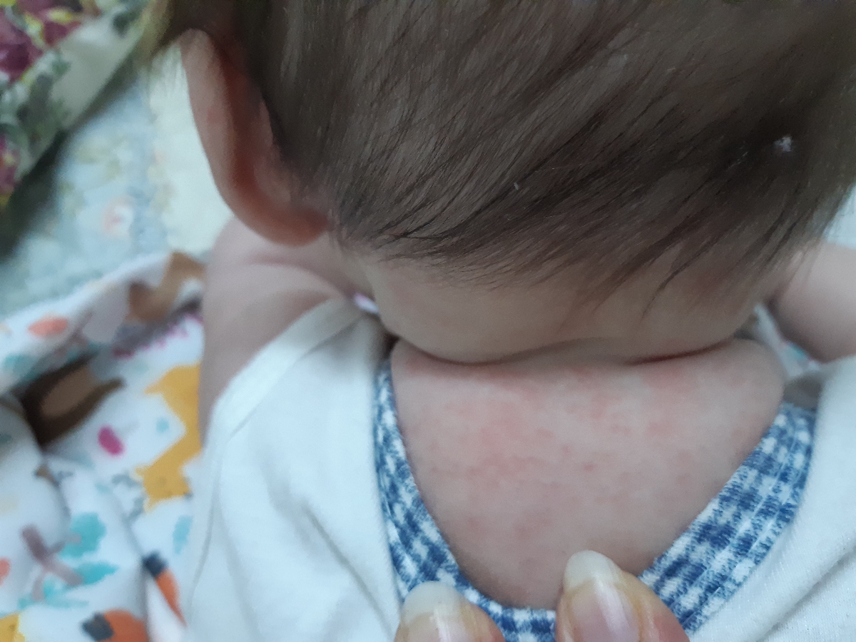 این عکس پشت گردنش به نظرم از عرق شده این عکس پشت گردنش به نظرم از عرق شده