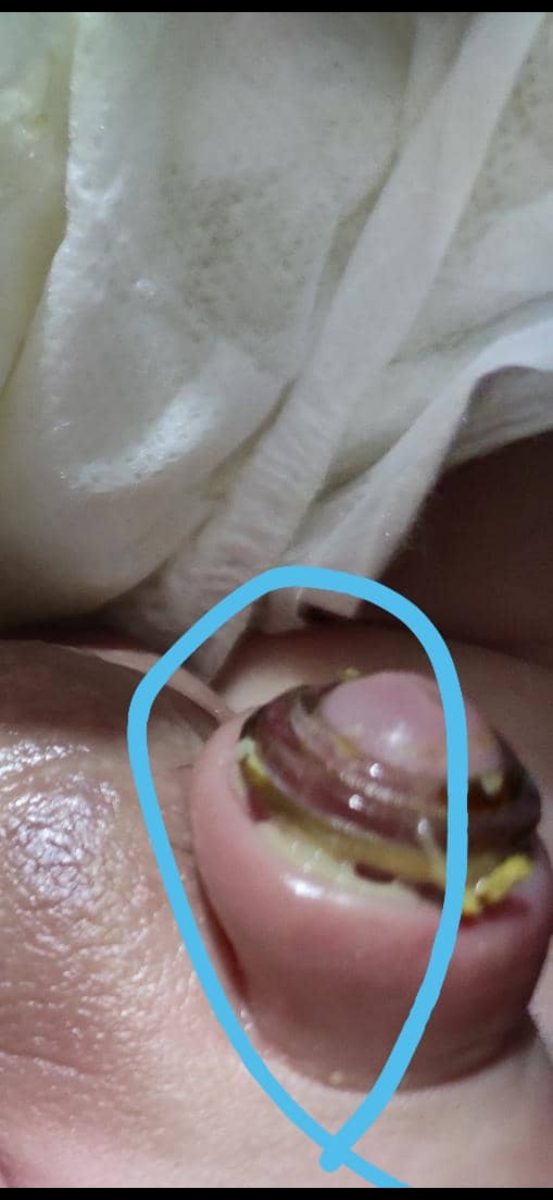 عکس و ختنه نوزاد عکس و ختنه نوزاد