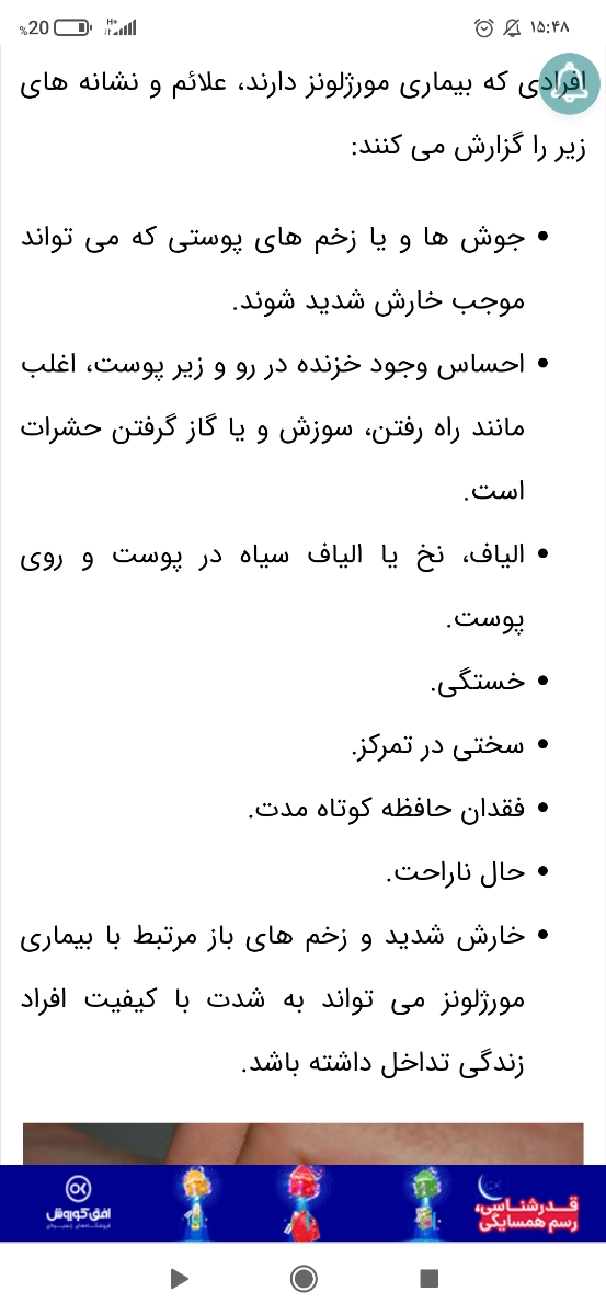 شوهرم میگه احساس میکنم زیرپوستم مثل مورچه یه جونوری میگرده