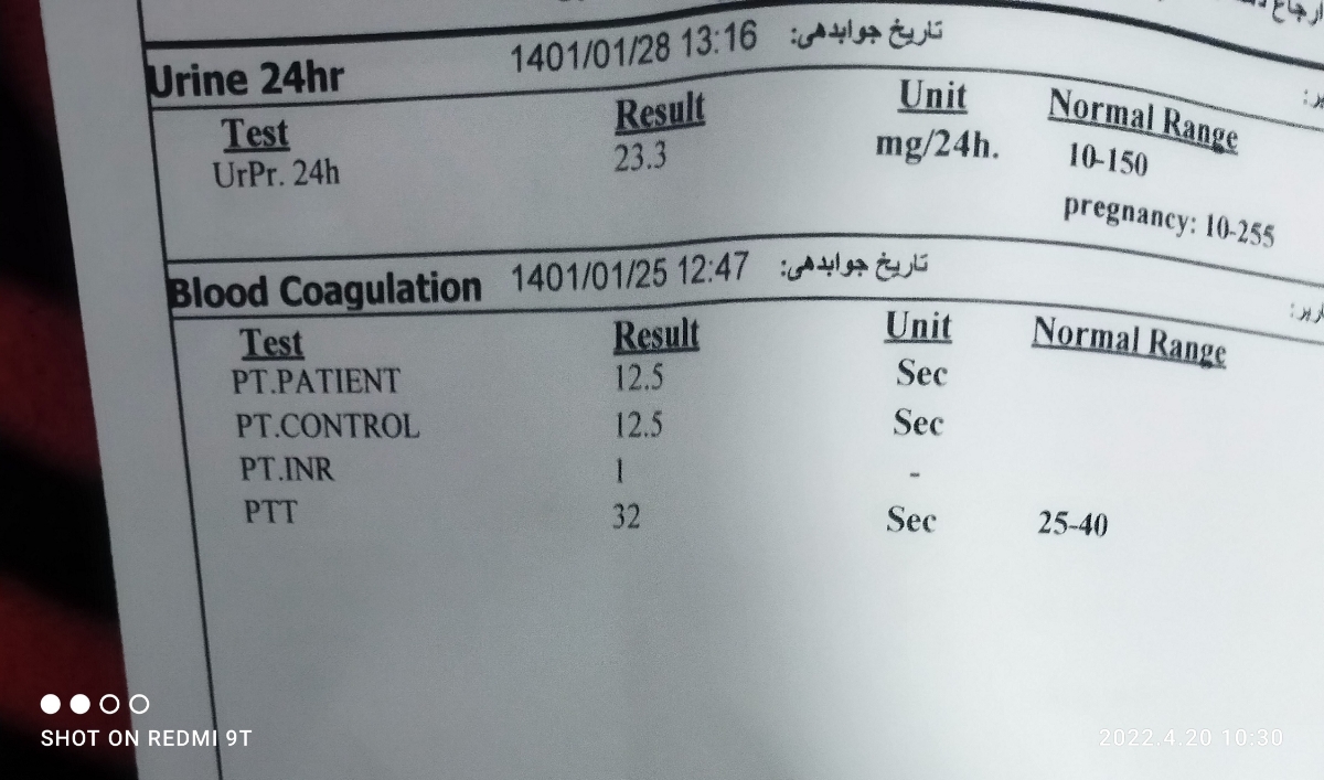 تفسیر آزمایش دفع پروتئین