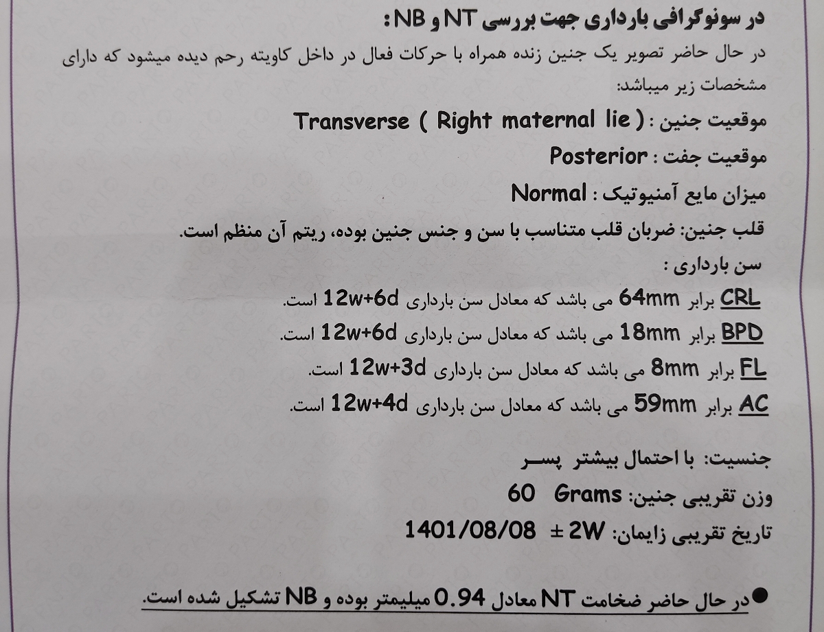 سونوگرافی Nt در 12 هفته