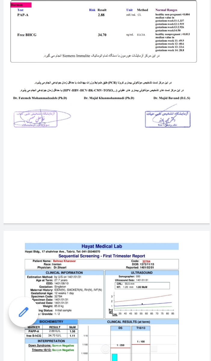 سونو ان تی و تعیین جنسیت