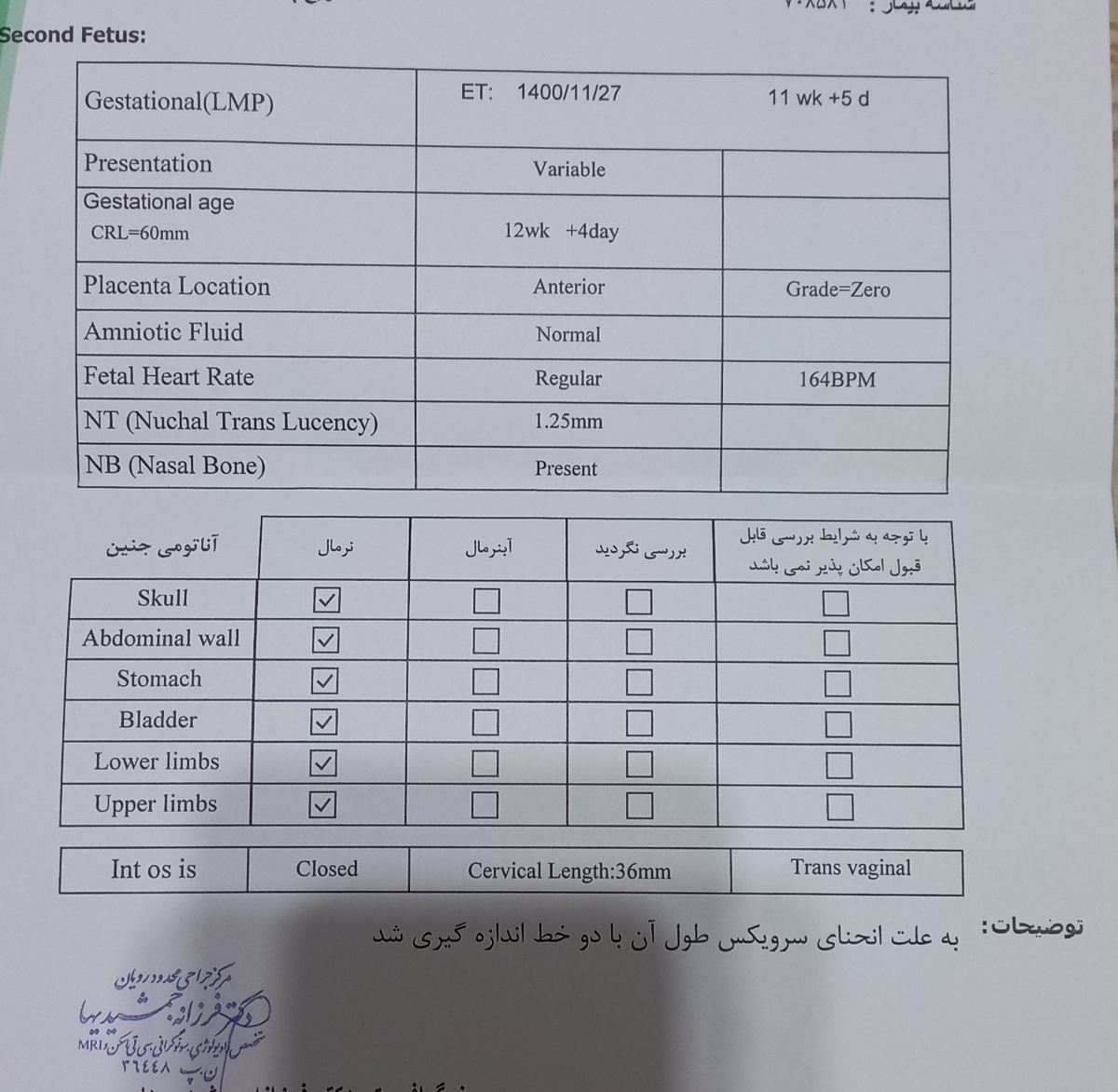 تفسیر سونو ان تی