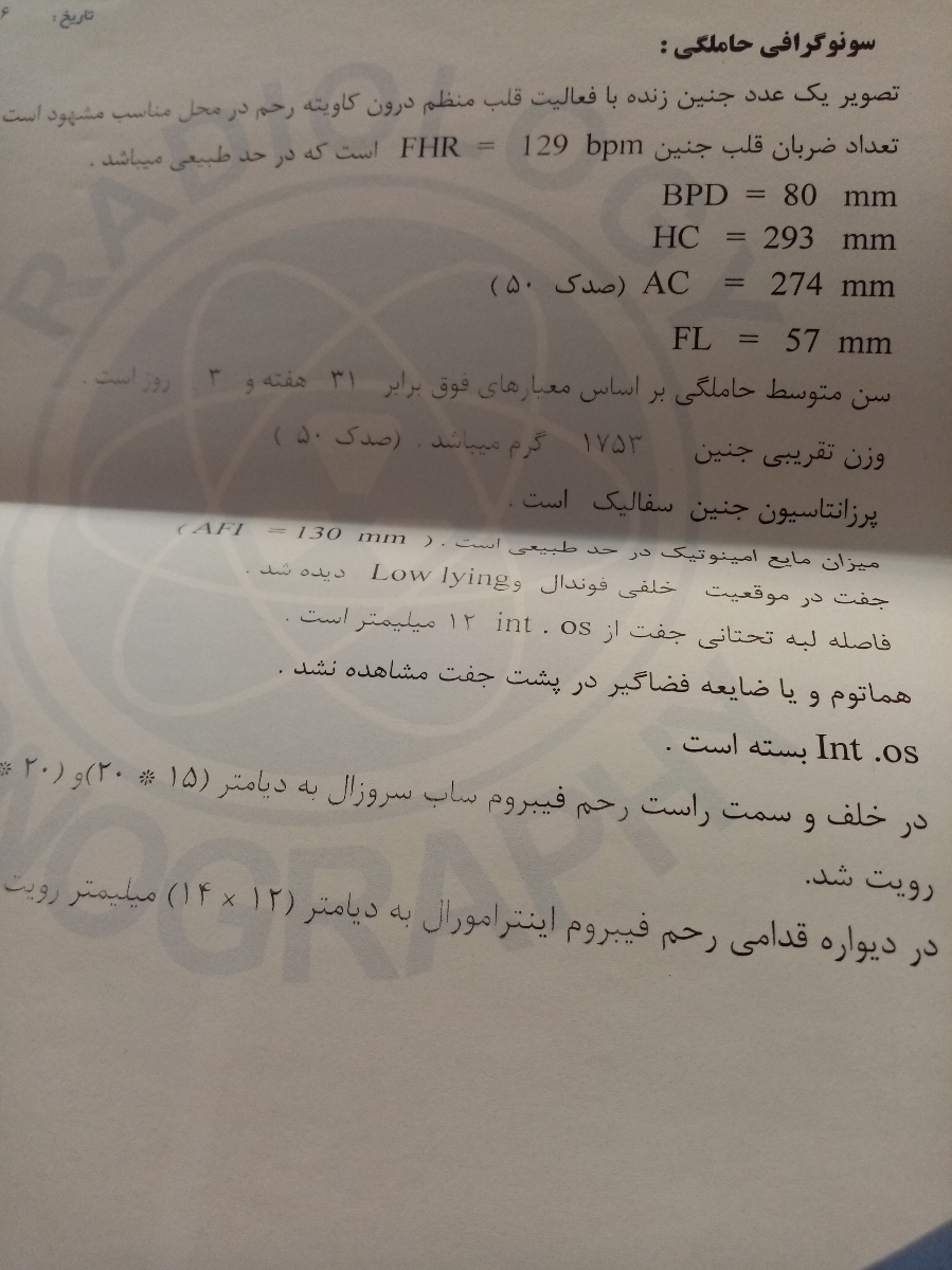 سونوی کالرداپلر و اکرتا سونوی کالرداپلر و اکرتا