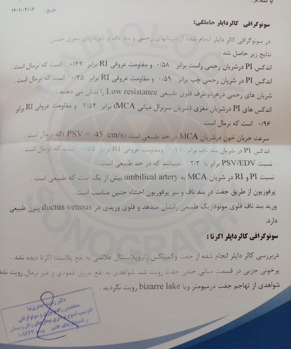 اکرتا و داپلر اکرتا و داپلر