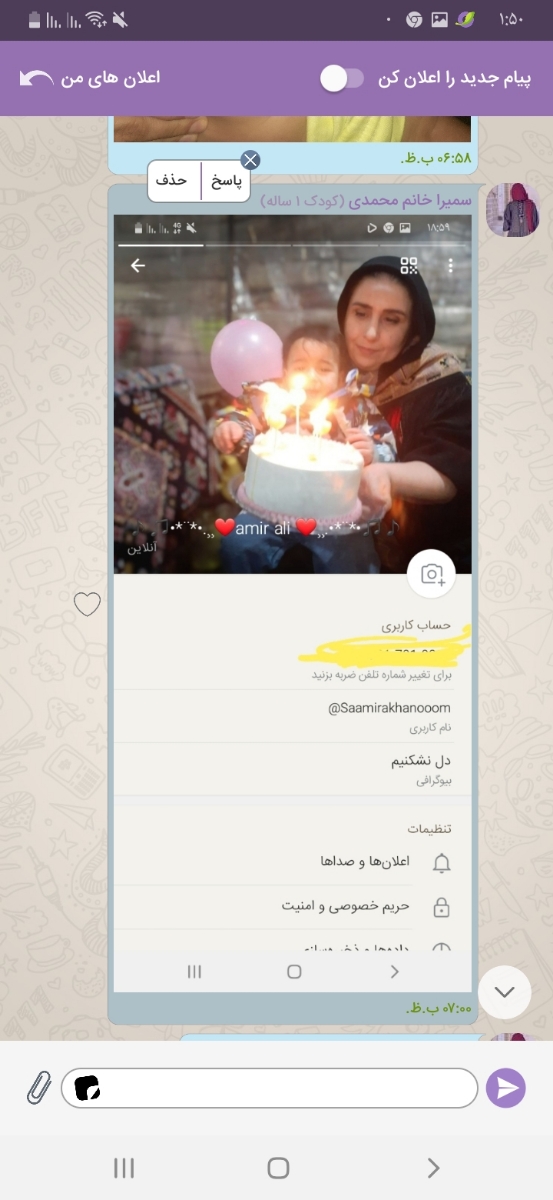 سوختگی دور باسن امیرعلی م سوختگی دور باسن امیرعلی م